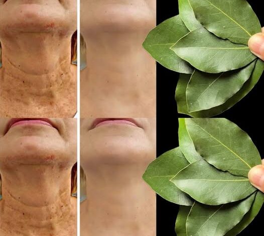 Bay Leaf Is 100,000 Times Stronger Than Botox? | Natural Wrinkle Eraser Even at Age 70!