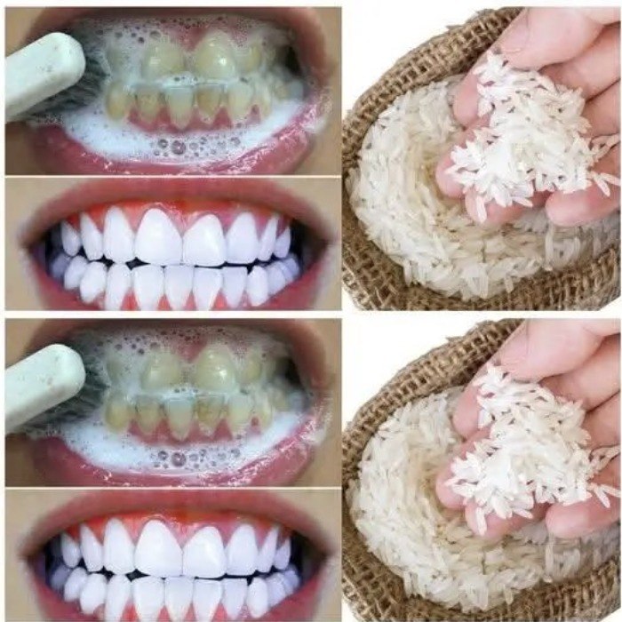 Whiten your teeth in just 1 minute with this simple home trick.