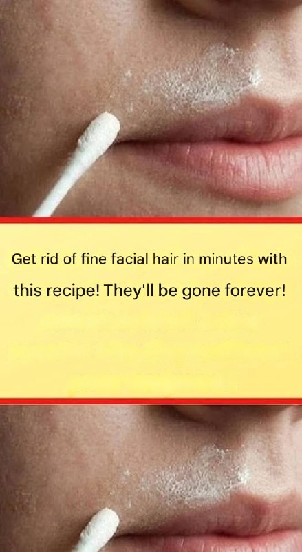 This natural recipe will permanently remove facial hair.